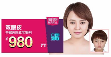 鞍山齊敏 980元雙眼皮手術，開啟美麗雙眸新篇章